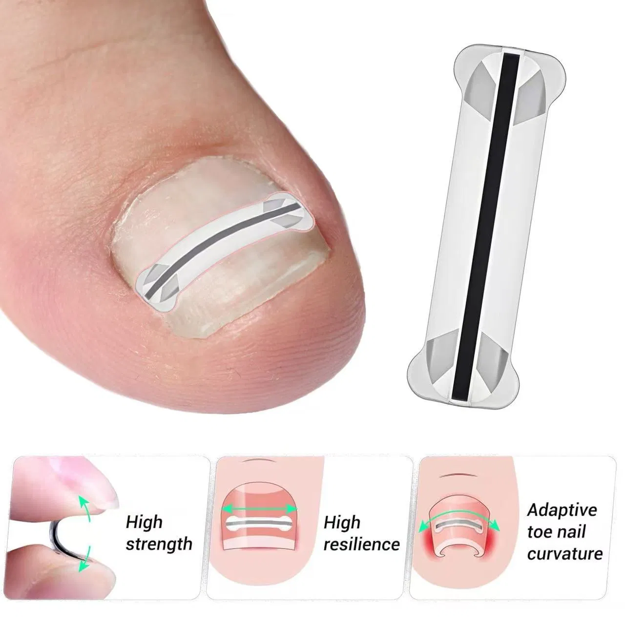 Professional Home Care for Curved Nails Titanium Alloy Ingrown Toenail Treatment