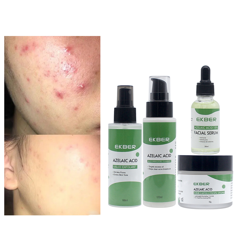 Azelaic Acid Facial Skin Care Oli Control Anti Acne Set