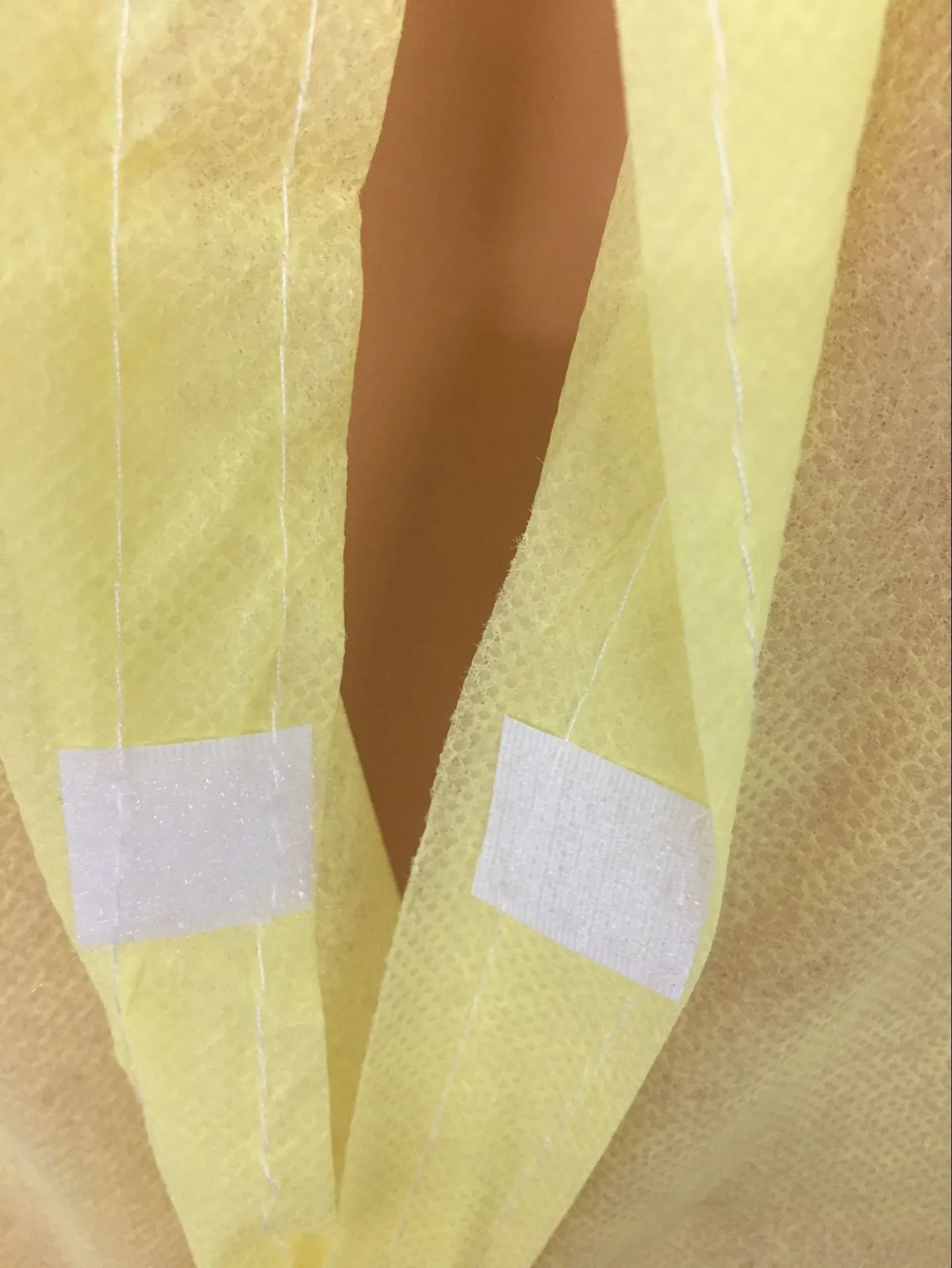 Disposable Isolation Non-Woven Yellow Gown