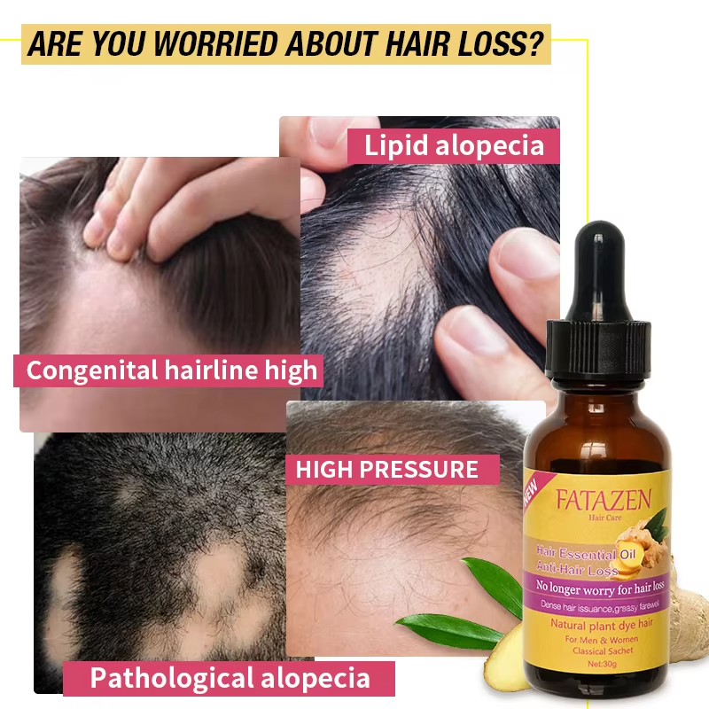 Hair Loss Turmeric Hair Growth Oil