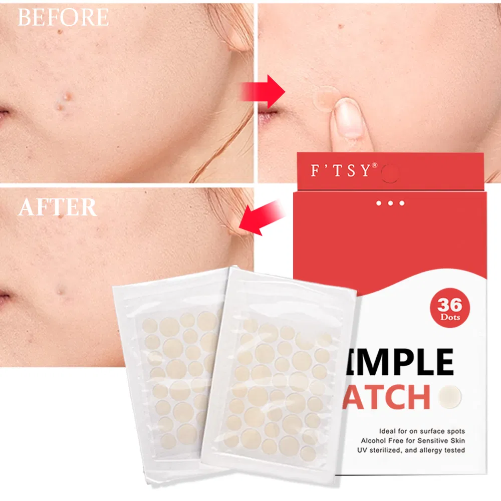 OEM Factory Price Organic Acne Treatment Pimple Patches with Tea Tree Face Care