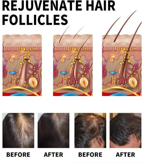 OEM ODM Natural Hair Growth Serum Hair Regrowth Essential Oil Anti Hair Loss Nourishing Rosemary Hair Smooth Essential Hair Growth Serum