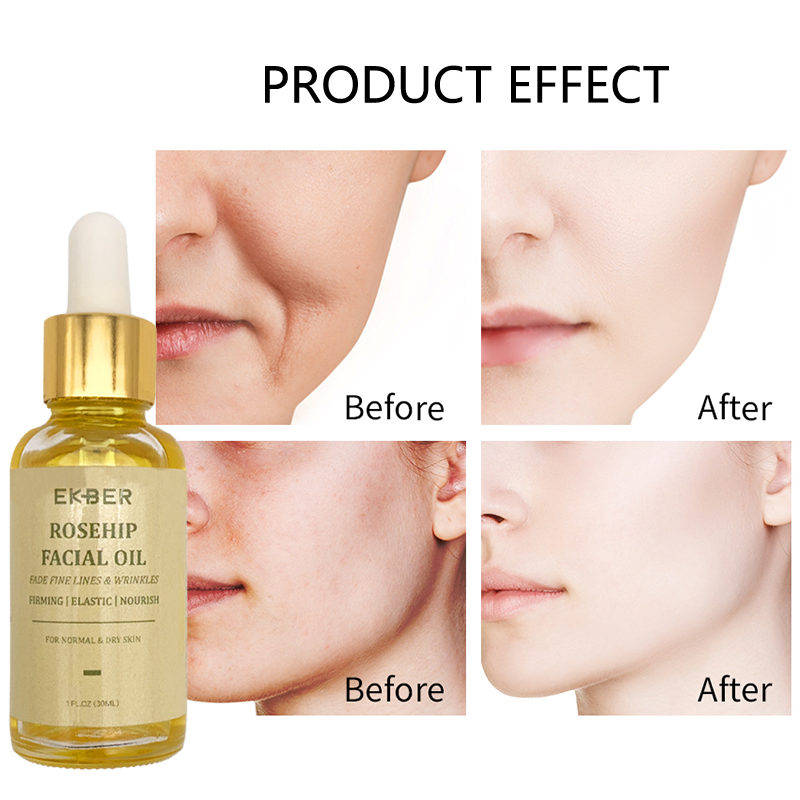 Customize Logo Amazon Hot Sale Soothing Nourishing Revitalizing Pure Rosehip Seed Oil Organic Skin Care Face Rosehip Oil