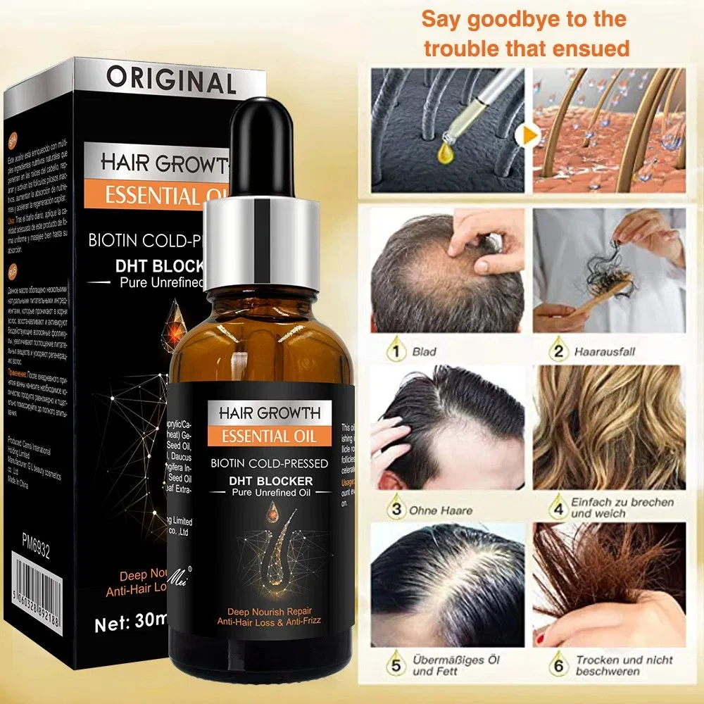 OEM/ODM Wholesale Organic Ginger Hair Essential Oil Natural Herbal Leave-in Scalp Care
