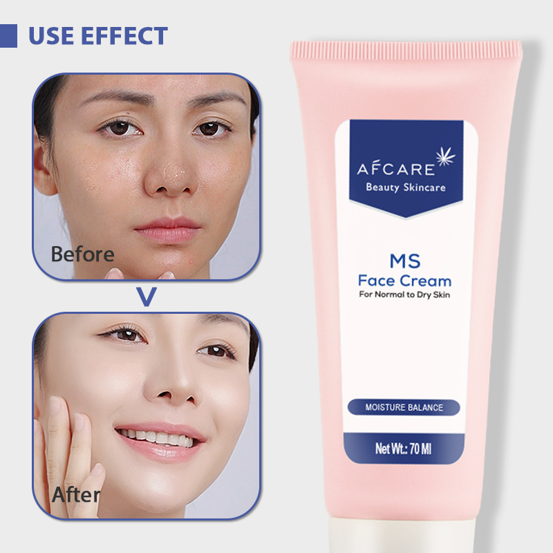 Factory Price Face Cream Natural Oraganic Moisturizing Anti-Acne Whitening