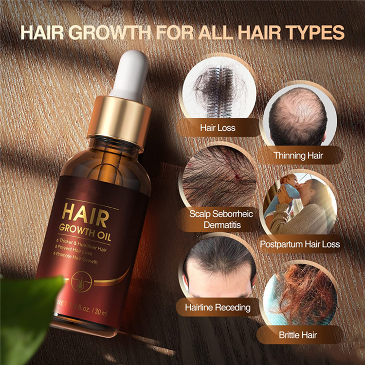 Premium Biotin & Castor Oil Hair Growth Elixir for Thicker Locks