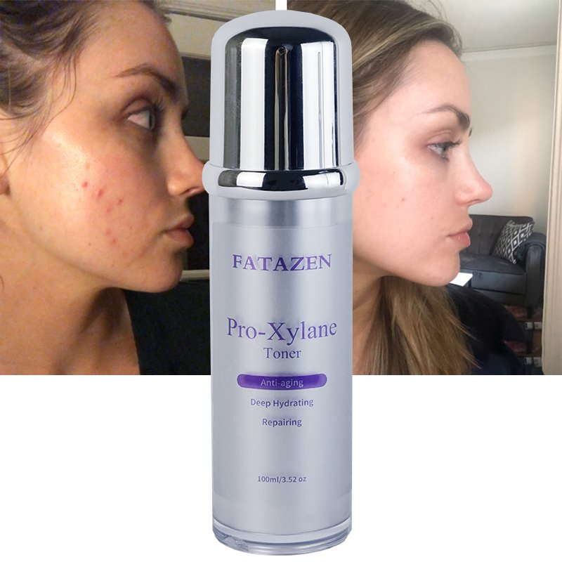 Vitamin C Anti-Aging Repairing Brightening Best Smooth Natural Face Toner Spray