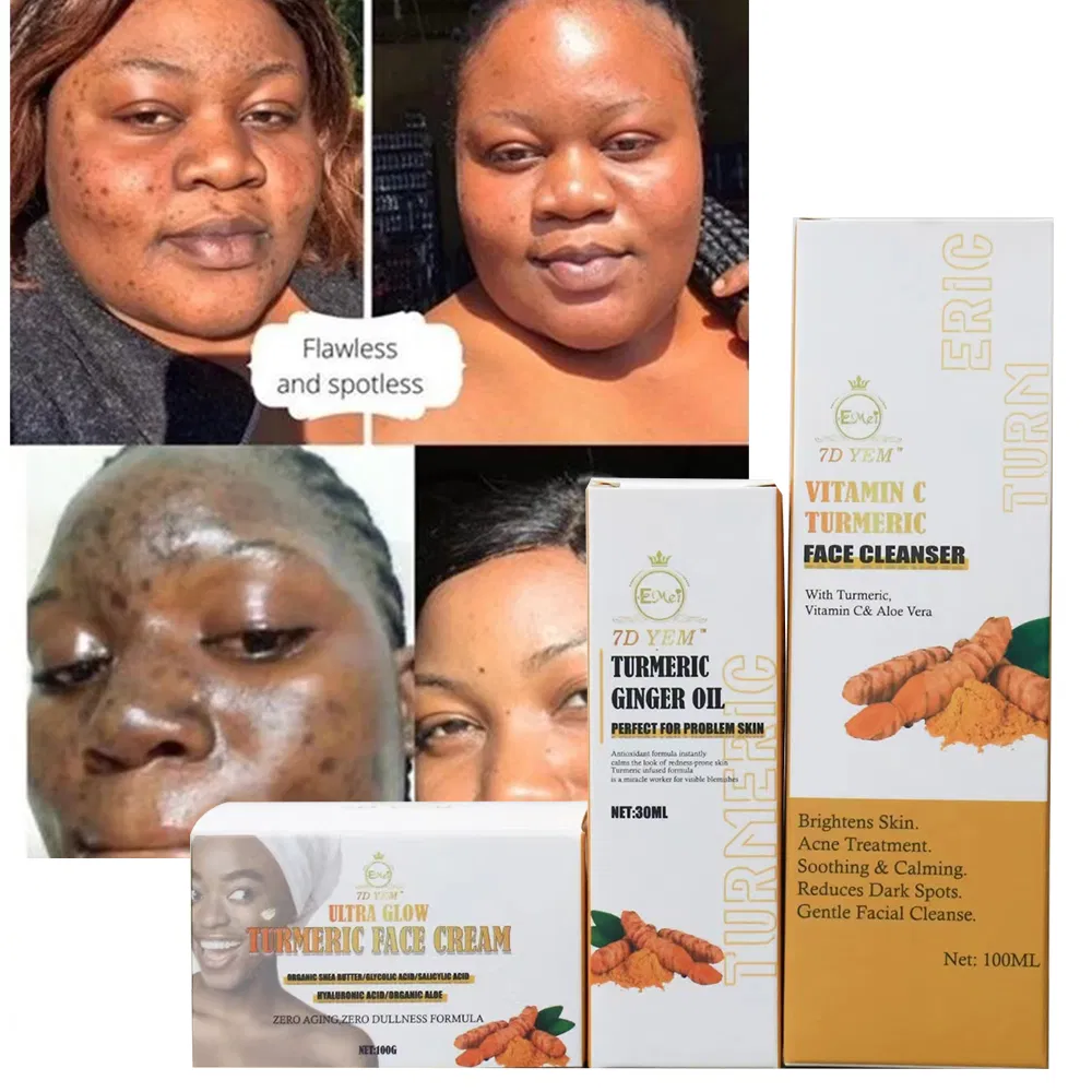High Quality Acne Treatment Aloe Vera Turmeric Facial Cleanser Essential Oil Cream Quick Cleaning Turmeric Skincare Set