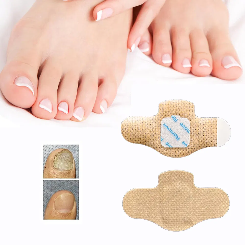 Skin Care Nail Sticker Hydrogel Overnight Toe Nail Repair Patches