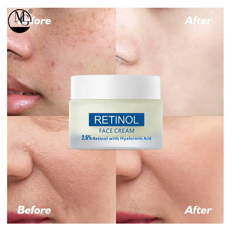 Lasts 48 Hours Organic Hyaluronic Acid Face Cream Fragrance-Free Face Cream