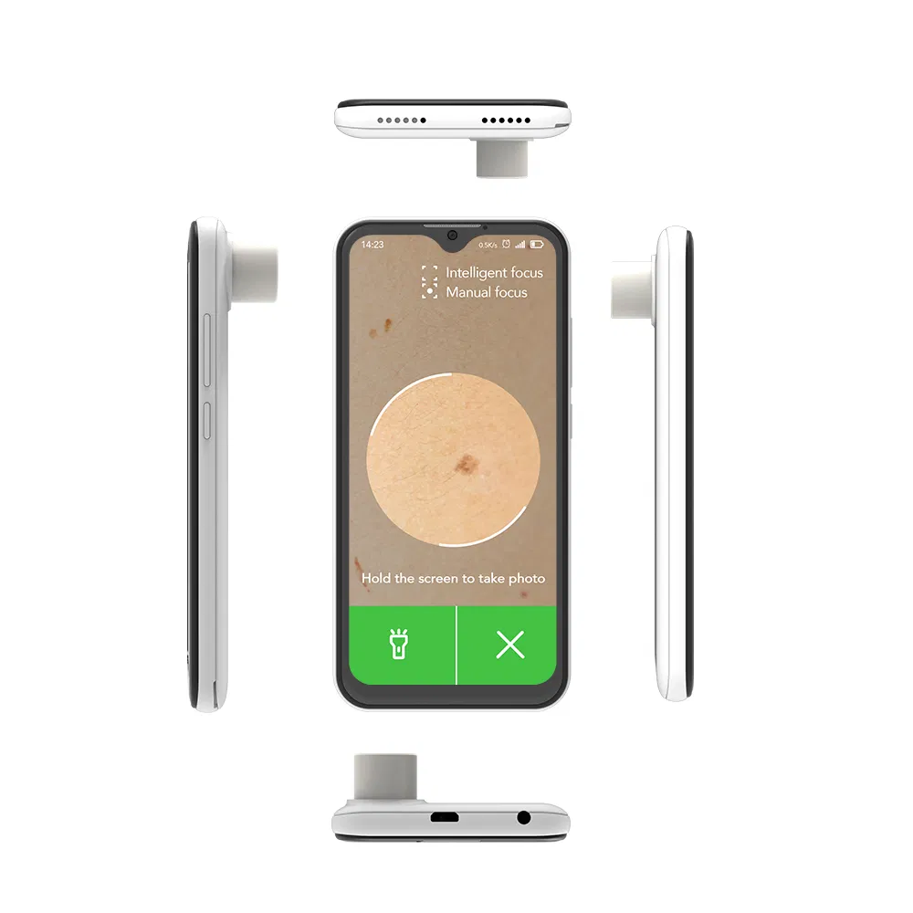 Custom 5 Inch Android Smartphone 4G Smartphone 720*1280 HD Mipi Mt6739 with 4X/60X Magnify Lens Skin Care Tools