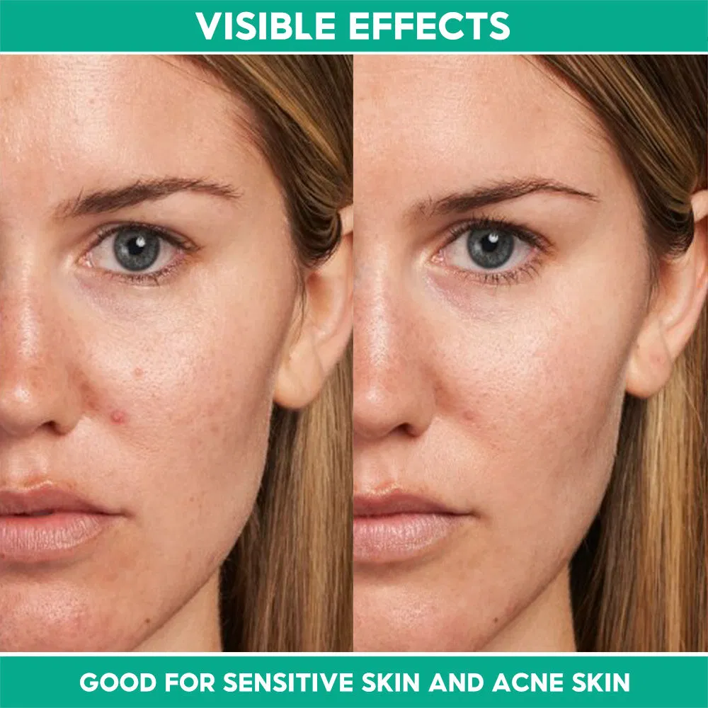 Calming Skin Centella Asiatica Soothing Vegan Facial Tone for Acne Sensitive Skin