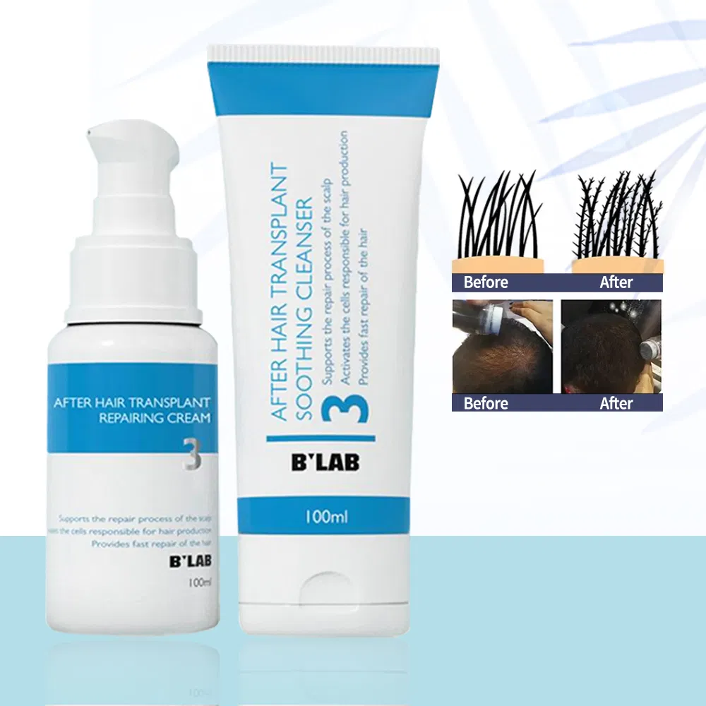 Private Label Natural Head Scalp Care Product After Hair Transplant Repairing Cream