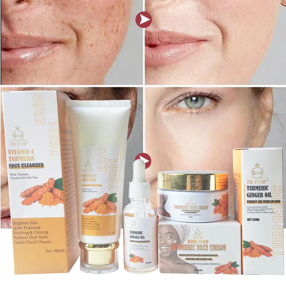 High Quality Acne Treatment Aloe Vera Turmeric Facial Cleanser Essential Oil Cream Quick Cleaning Turmeric Skincare Set