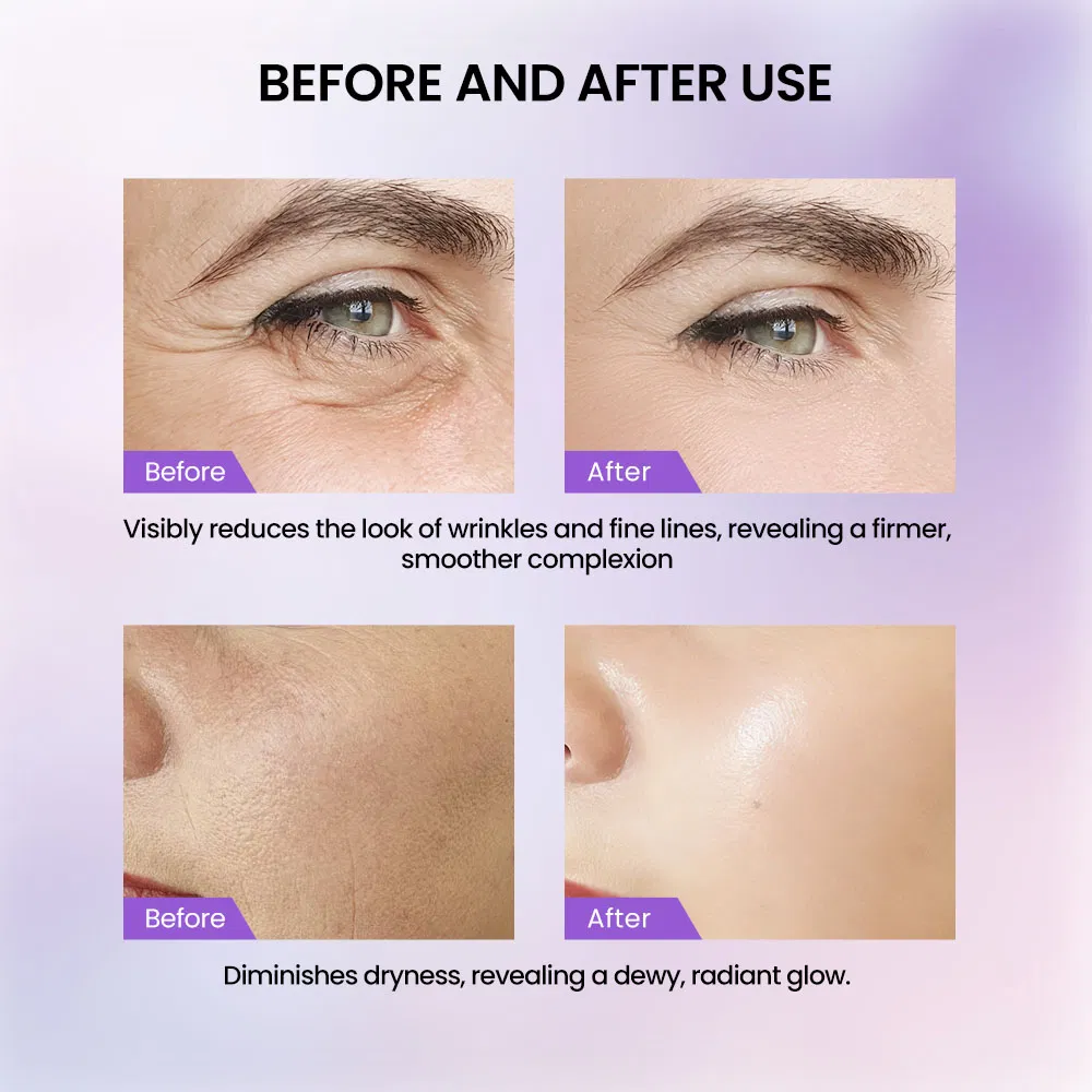 Restore Elasticity Anti Wrinkles Anti Aging Face Serum Hyaluronic Acid Collagen Serum