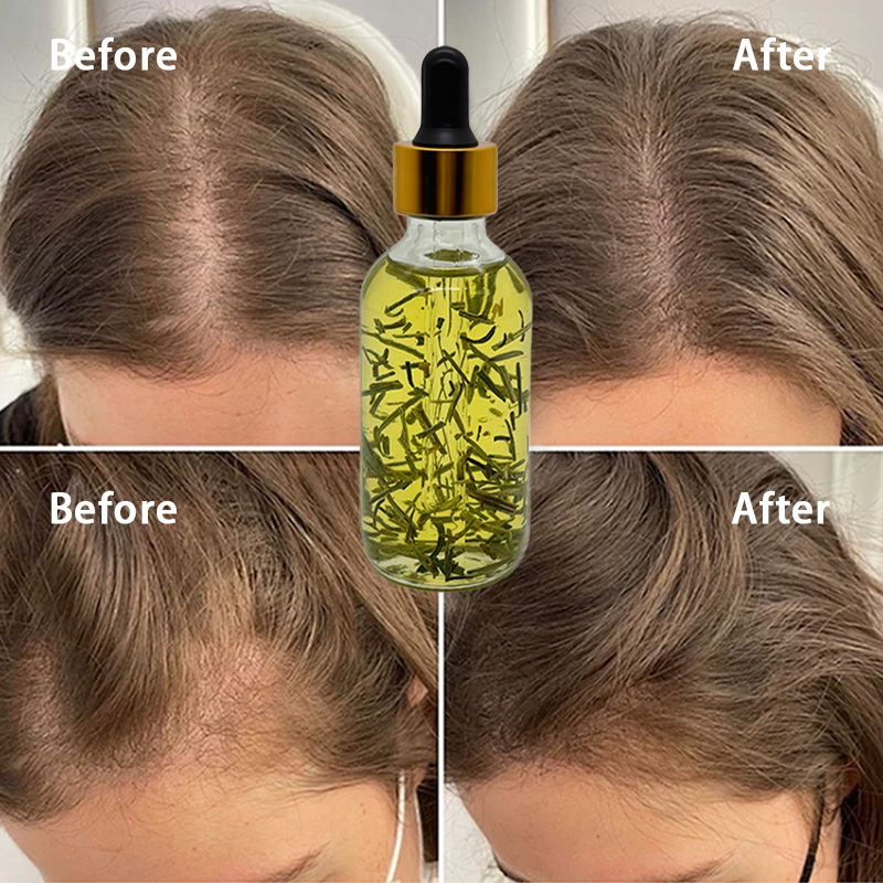 60ml Olive Oil Rosemary Essential Oil Hair Care Regrowth Herbal Anti Hair Loss Hair Plant Extract Essential Oil Serum