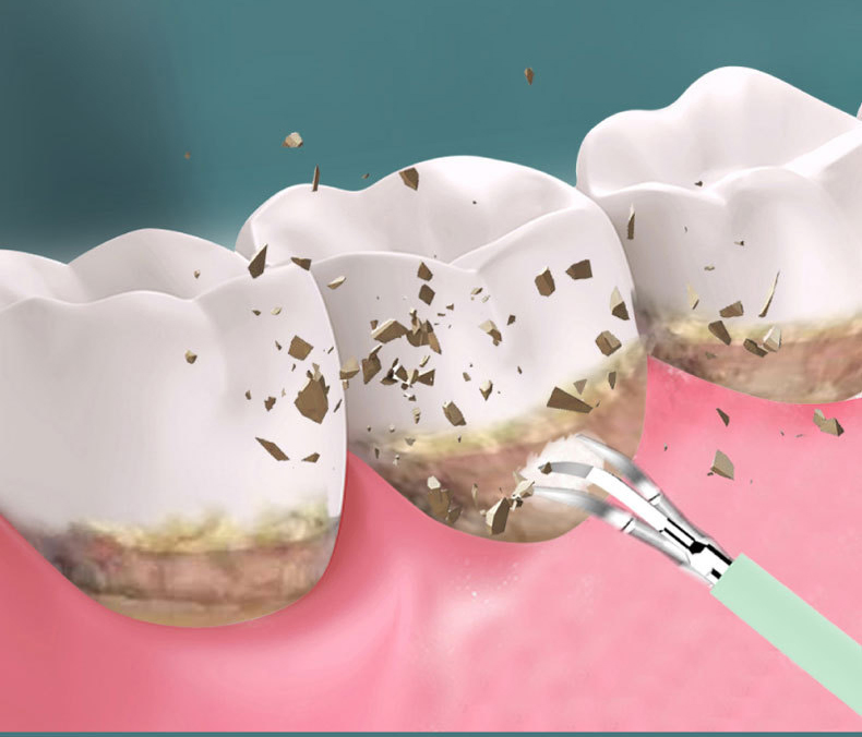 High Quality Ultrasonic USB Rechargeable Oral Care Deep Cleaning Electric Toothbrush