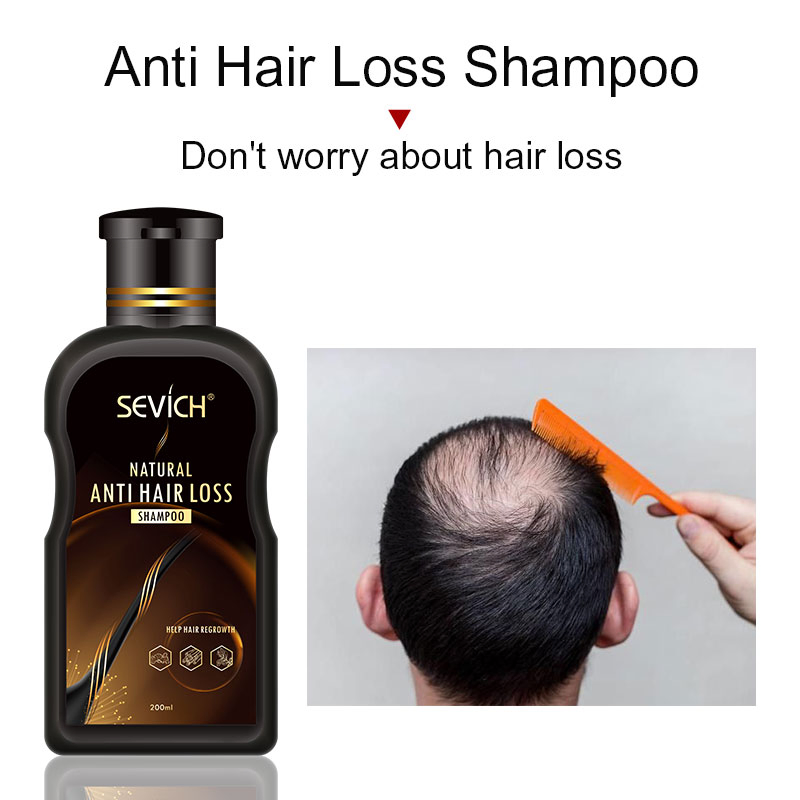 Effective Thin Hair Solution Prevent Hair Loss Shampoo