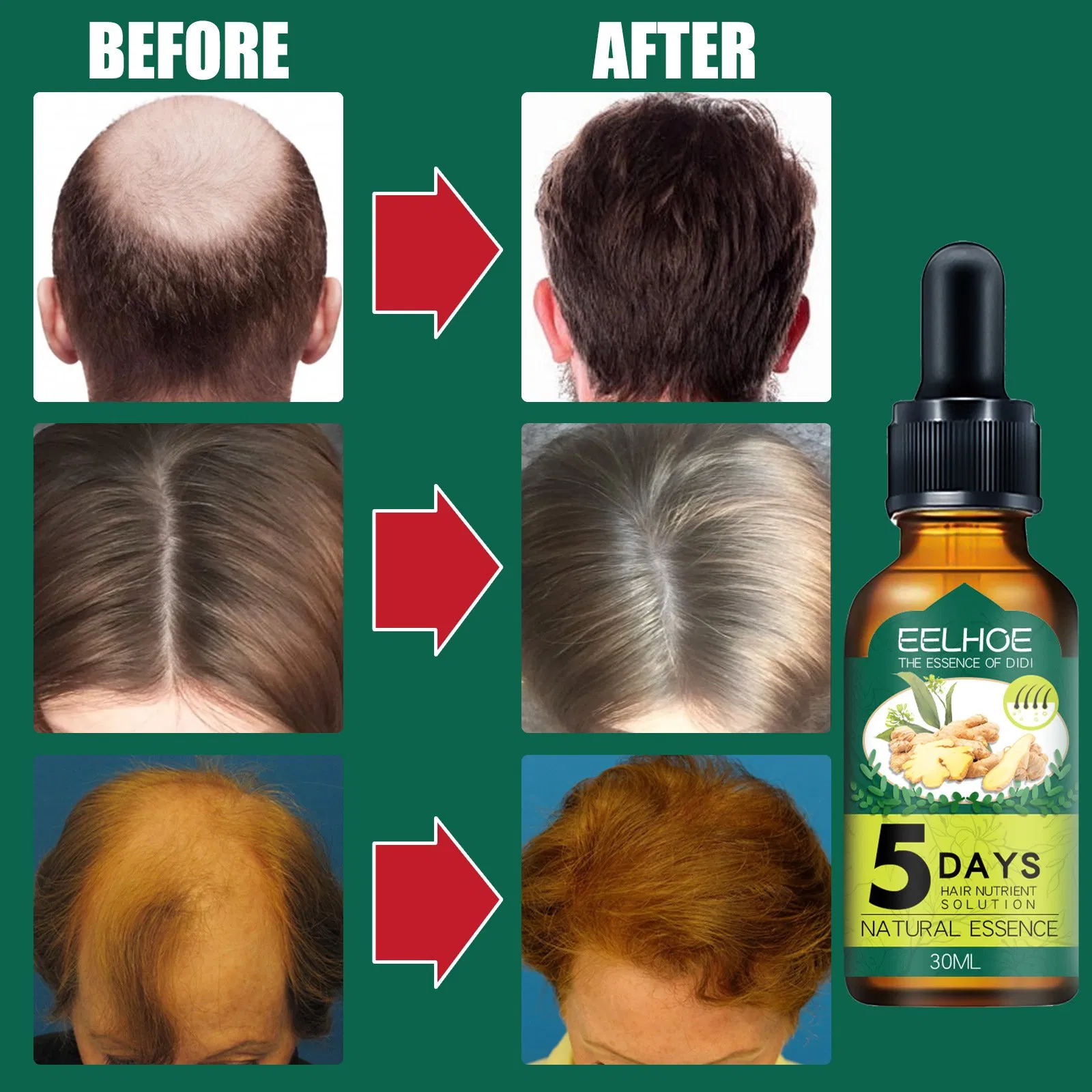 Wholesale Hair Growth Serum Anti Hair Loss Repairing Ginger Vitamin Care Essential Hair Growth Oil