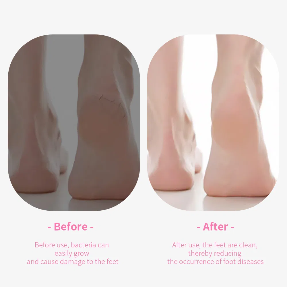 Oval Shape Foot Care SPA File Scrubber Hard Dead Skin Callus Remover Pedicure Pumice Stone Tool