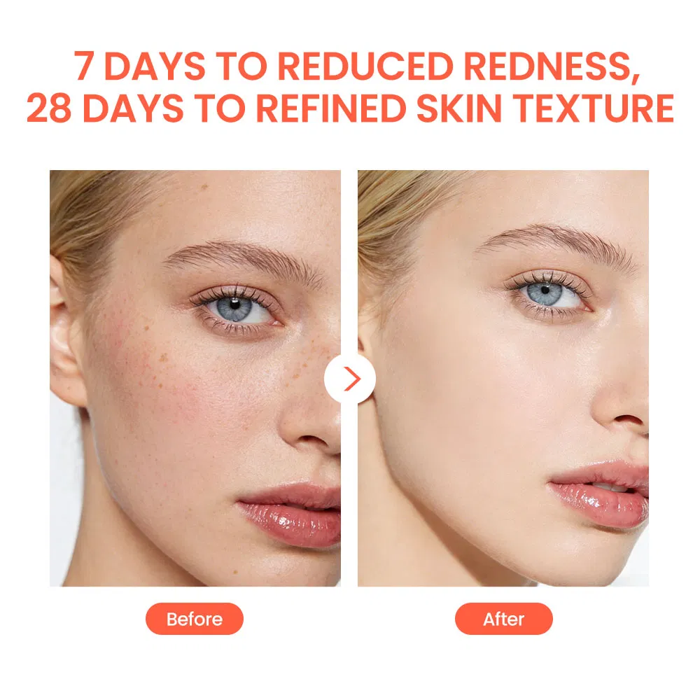 Snail Vc Moisturizing and Hydrating for Essence Anti-Wrinkle and Lightening Skin