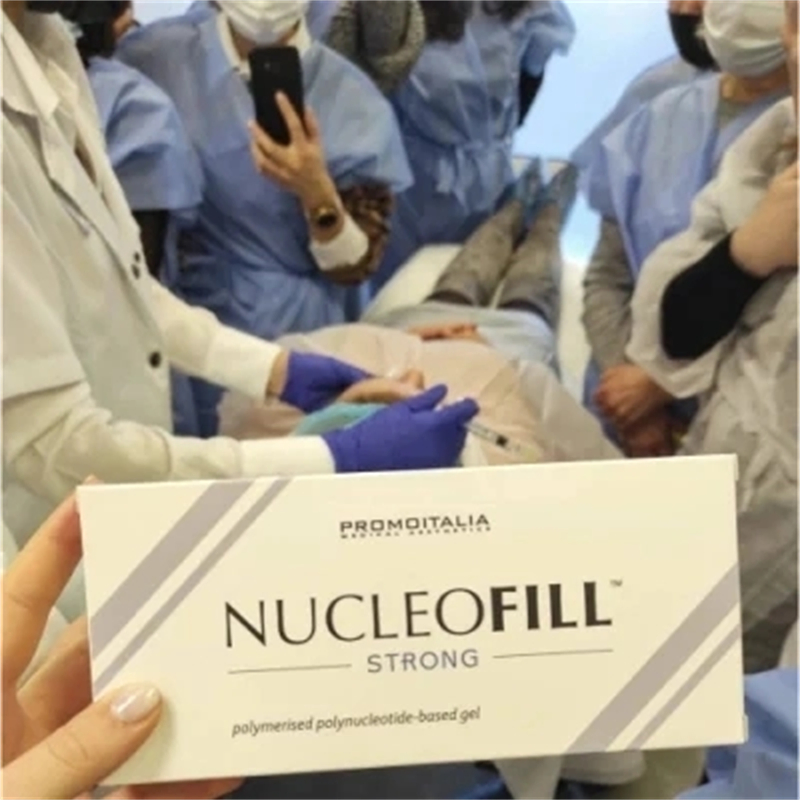 Nucleofill Strong Facial Skin Moisturizing Sodium Profhilo Dermal Filler Skin Rejuvenation