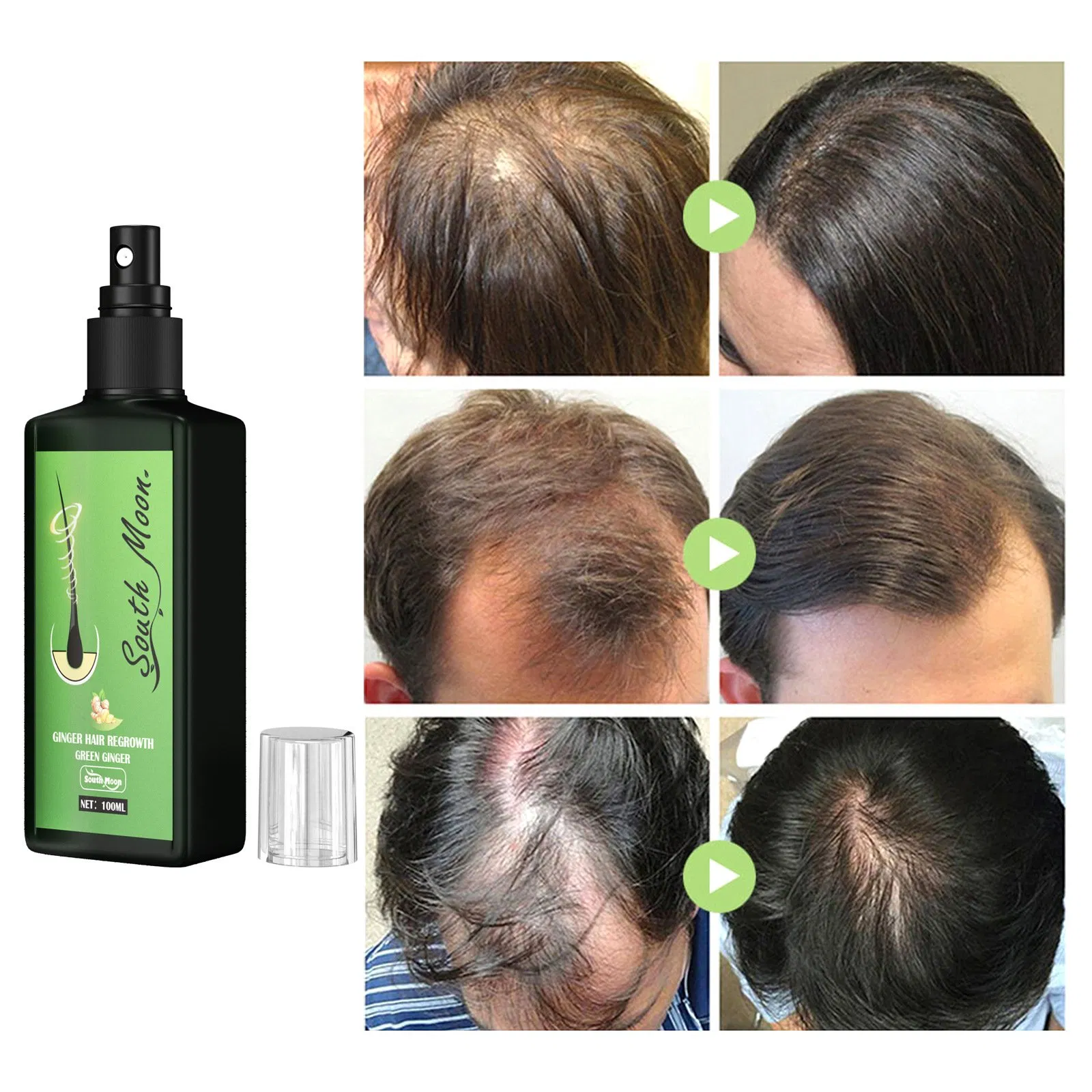 Hair Growth Serum Spray Fast Growth Liquid Treatment Scalp Hair Follicle Natural Health Anti Hair Loss Spray