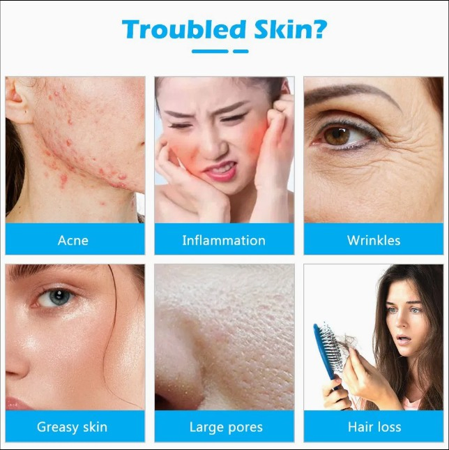 Portable Multi-Tube High Frequency Beauty Wand for Anti-Acne and Skin Firming