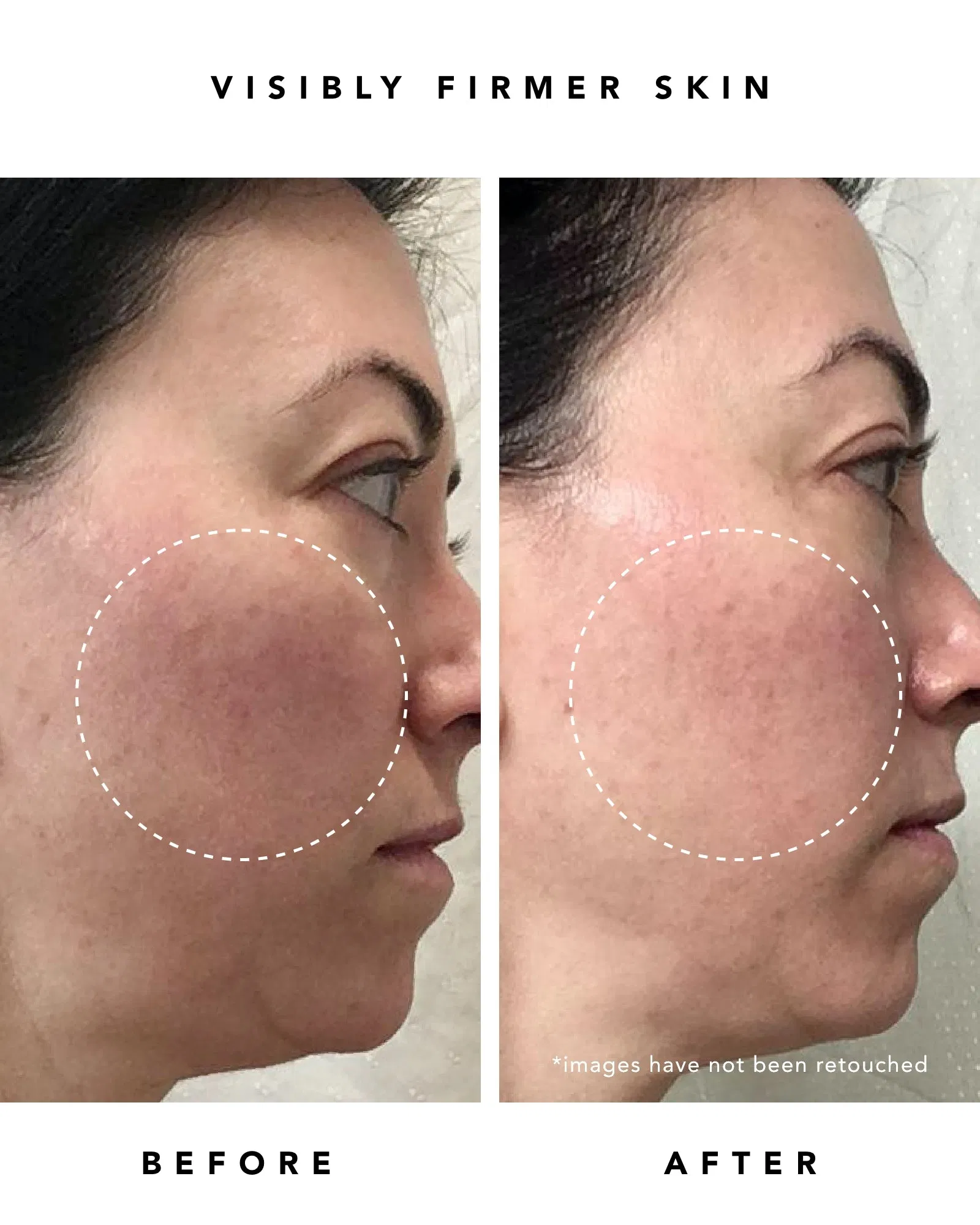 Beauty Cosmetics Skin Care Peptides Retinol Serum Anti Aging Whitening