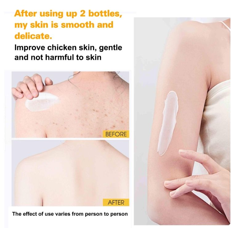 Active Super 7 Days Whitening Body Lotion - Improve Skin Tone & Nourish Skin Care