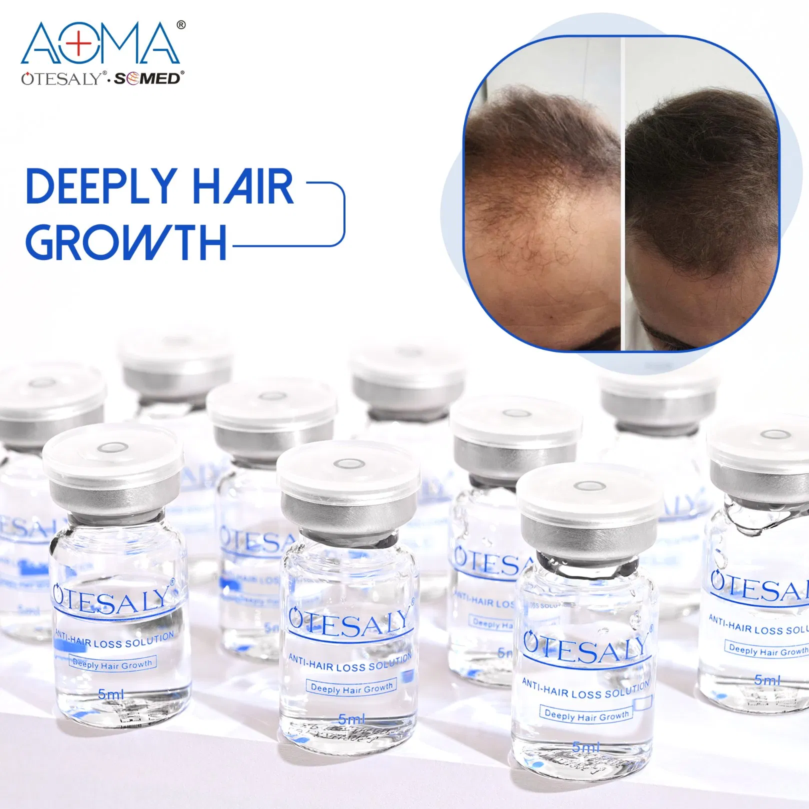 Otesaly Anti-Hair Loss Hair Growth Injection Serum Meso Hair Needling Mesotherapy
