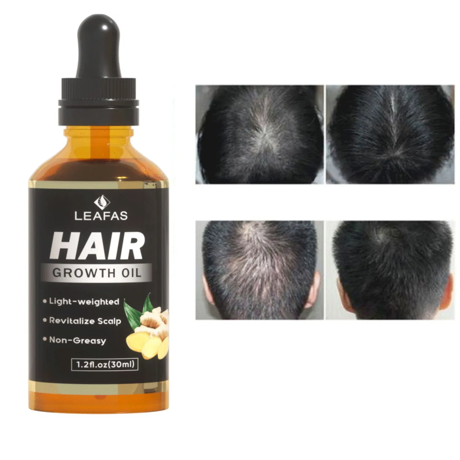 Custom Logo Natural Hair Growth Oil for Stronger Thicker Longer Hair