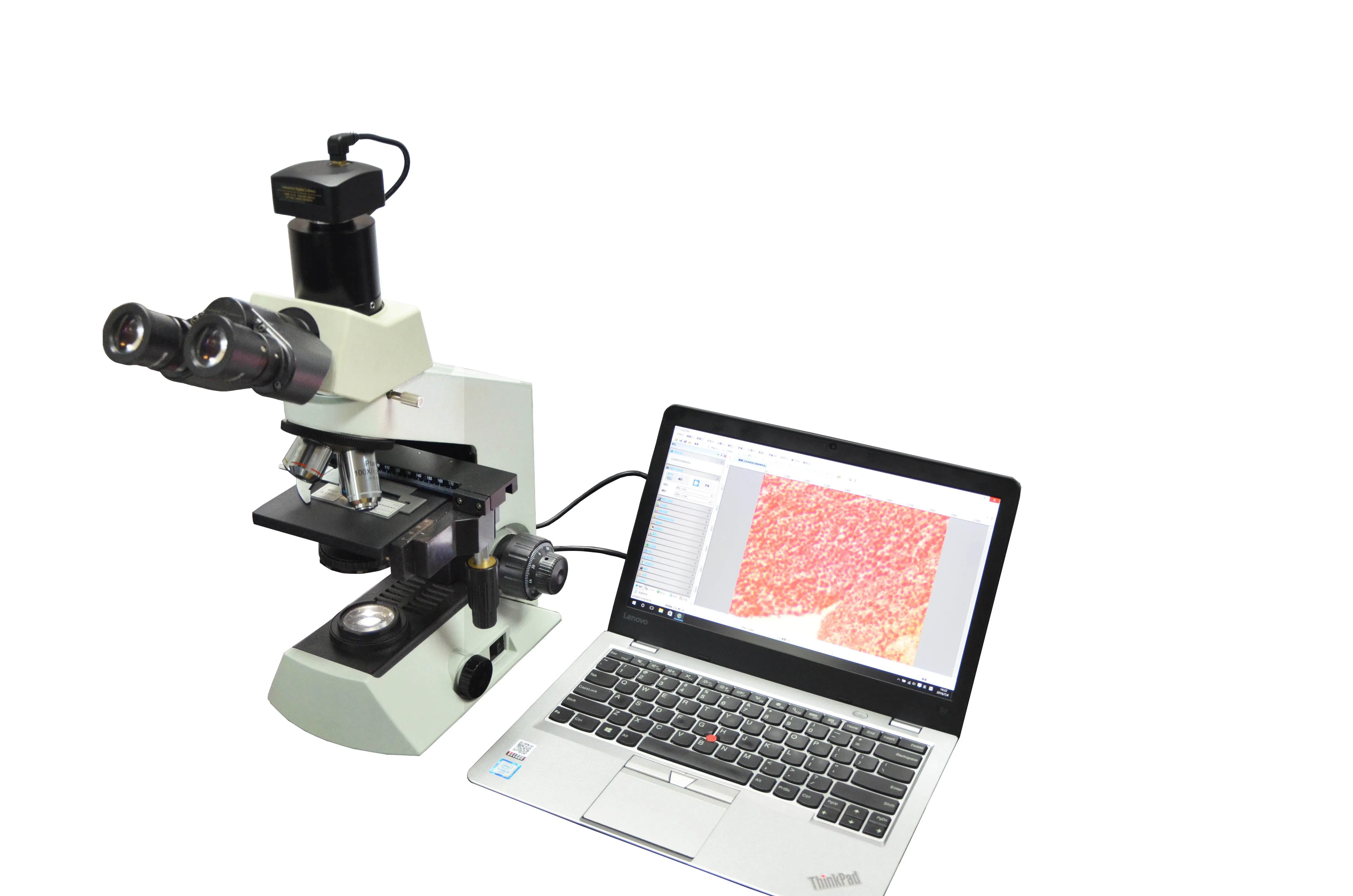 603100A Microscope Camera Used USB2.0 as The Data Transfer Interface