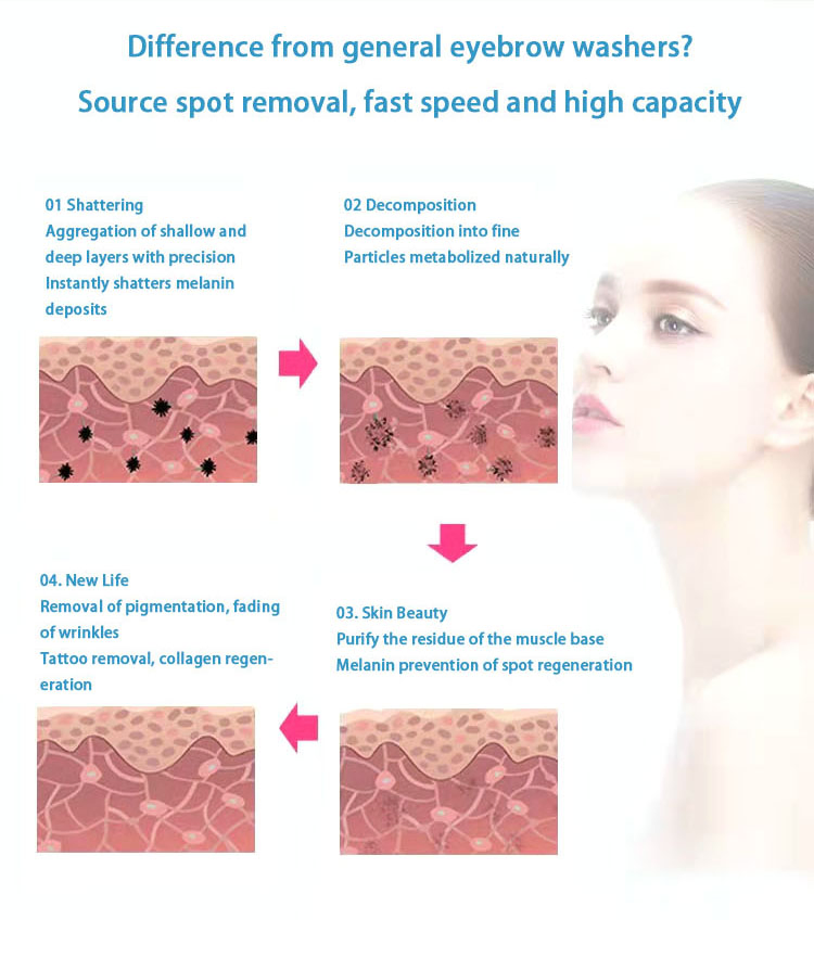 Picolaser Tattoo Removal Pigment Removal Machine Skin Whitening Picosecond Laser with CE Approved