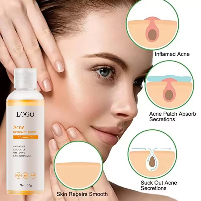 Ditong OEM/ODM Acne Removing Toner
