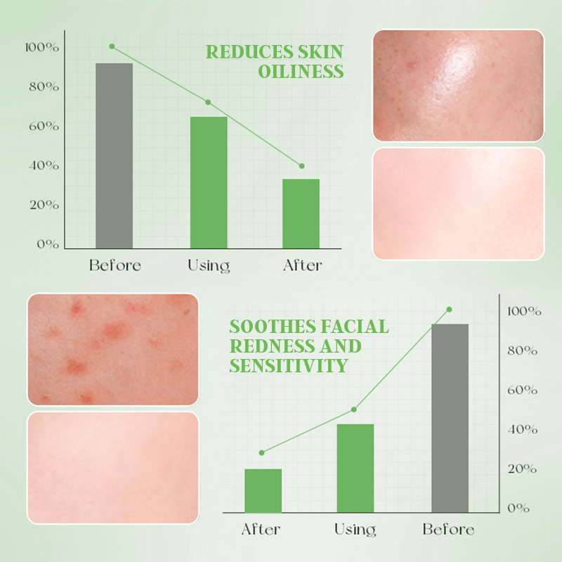 Custom Logo Amino Acid Cleansing Mousse Pore Cleansing Antioxidant