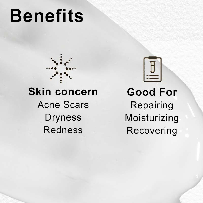 OEM Skin Care Moisturizing Anti-Aging Snail Mucin Face Cream