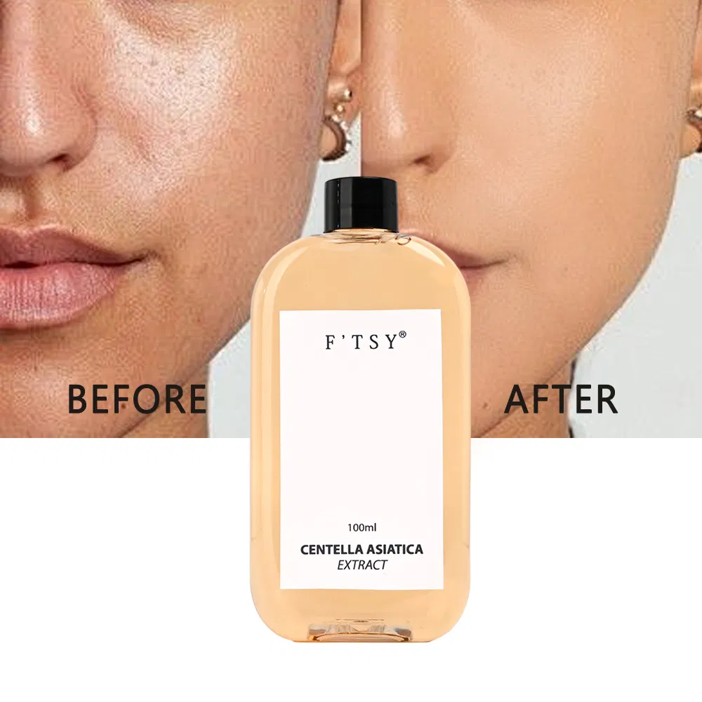 Facial Daily Toner for Oily Skin Centella Asiatica Extract Toning