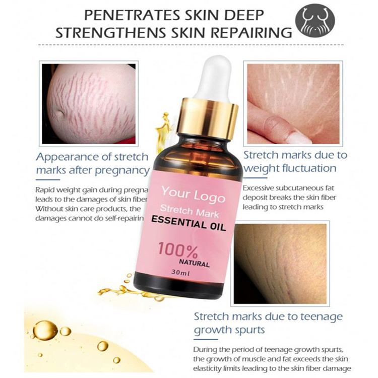 100% Natural Deep Strengthens Skin Repairing Stretch Mark Essential Oil