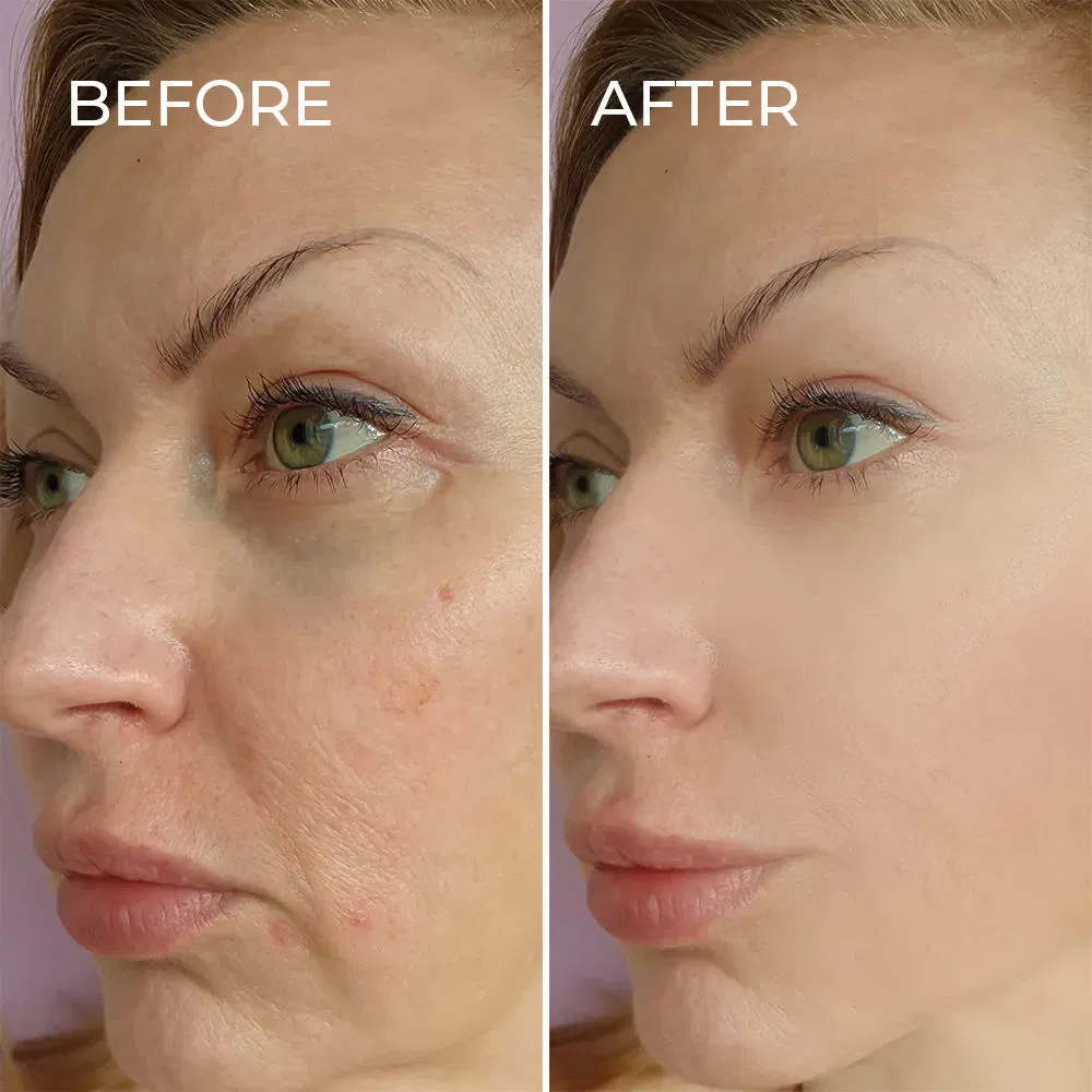 OEM Anti Aging Moisturizing Refreshing Facial Toner