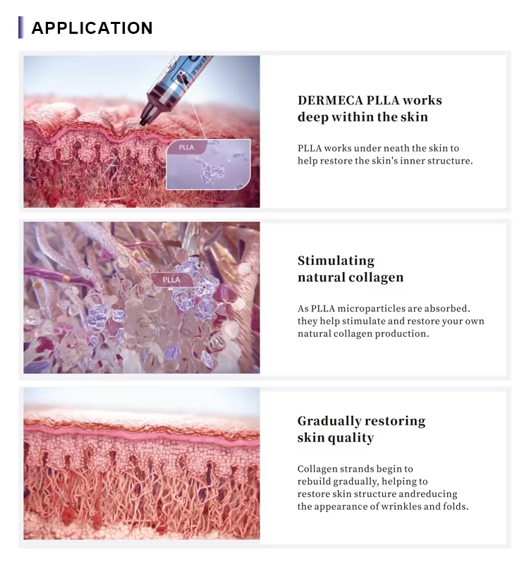 Dermeca Anti-Wrinkle Injectable Polylactic Acid Filler for Skin Rejuvenate