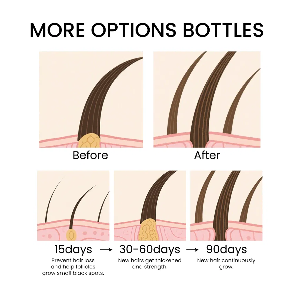 Luxury Premiume Biotin Strengthen Ginger Scalp Care Rosemary Growth Anti Hair Loss Repairing Treatment Hair Regrowth Serum Oil