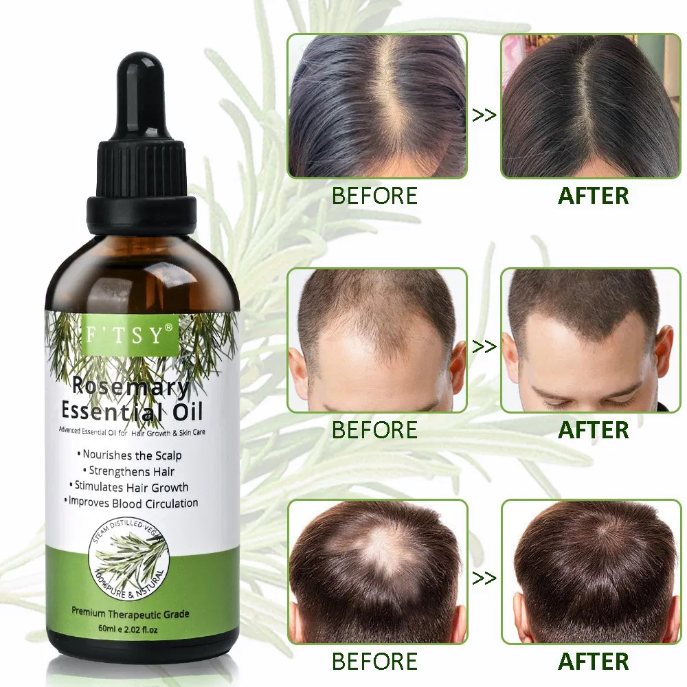 Custom Logo Hair Care Rosemary Hair Growth Oil Reduce Hair Loss Purify Scalp Essential Oil