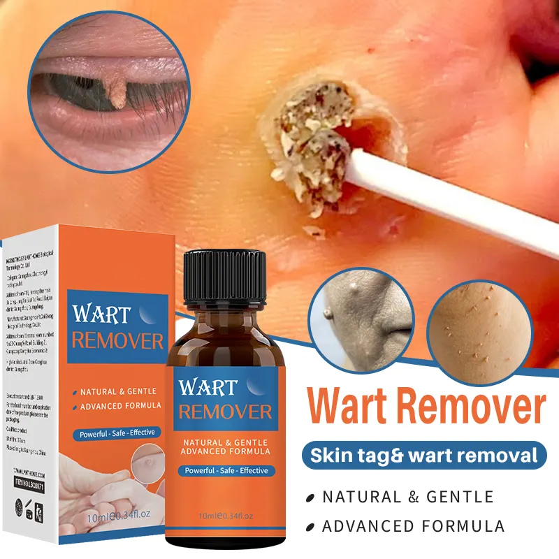 Beauty Cosmetics Skin Care Mild Powerful - Safe - Effective Wart Removing Oil