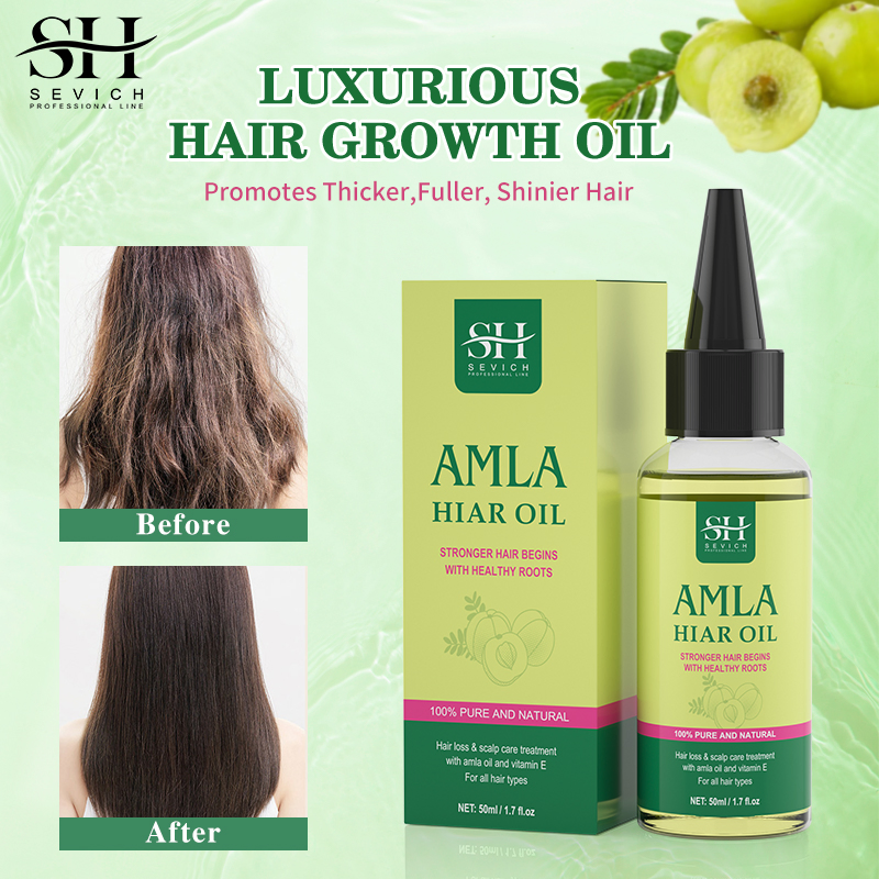 Hot Sell Hair Care Loss Treatment Amla Hair Growth Serum Oil