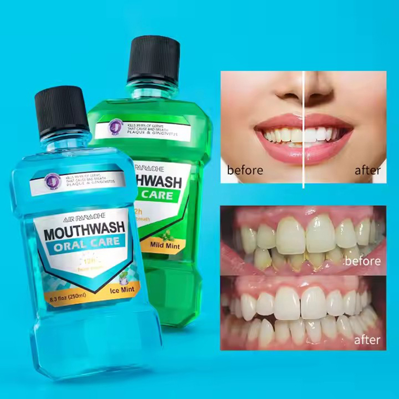 OEM Manufacturers Custom Cleaning Strong Mouth Wash Flavor Fights Plaque Gingivitis Teeth Sensation Ice Mint Mouthwash