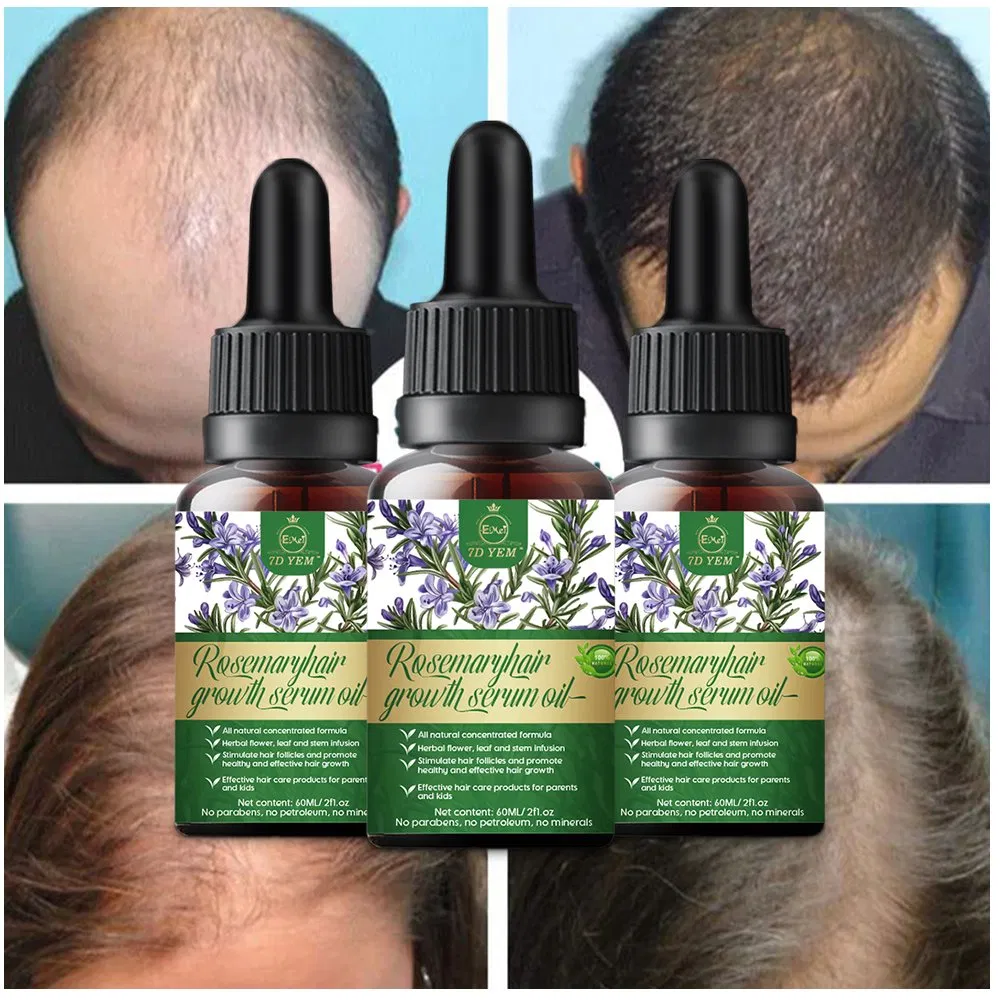 Private Label Tea Tree Essence Nourishes Scalp and Promotes Hair Growth Rosemary Hair Growth Oil