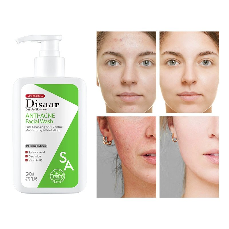 Salicylic Acid Facial Cleanser Organic Oil Control Ceramide Acne Treatment Skin Care Face Wash