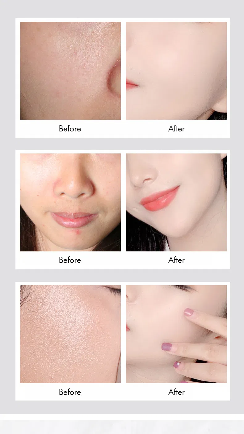 Private Label Moisturizing Anti-Wrinkle Niacinamide Whitening Cream Skin Care Set