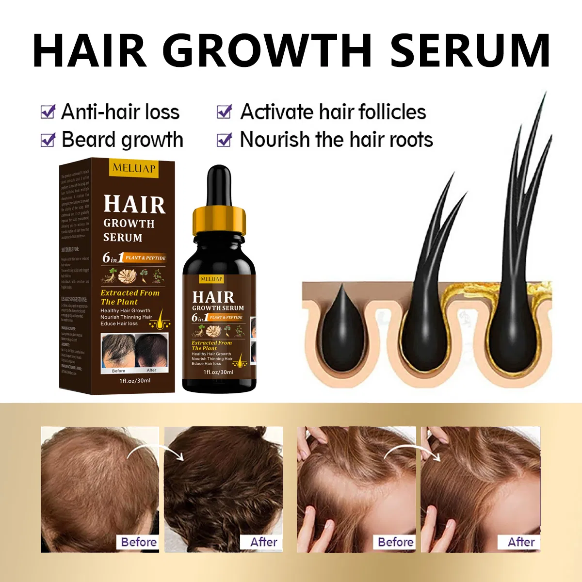 Hair Growth Serum Hair Lotion Oil Root Anti Loss Promotes Thicker Natural Nourishing Hair Scalp Anti Lost Hair Serum Private Label